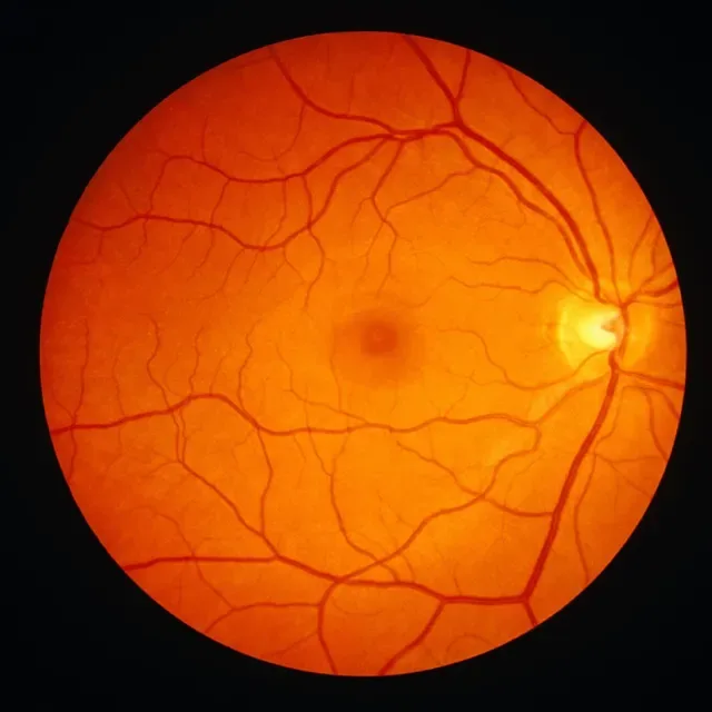 A retinal photo being analysed.