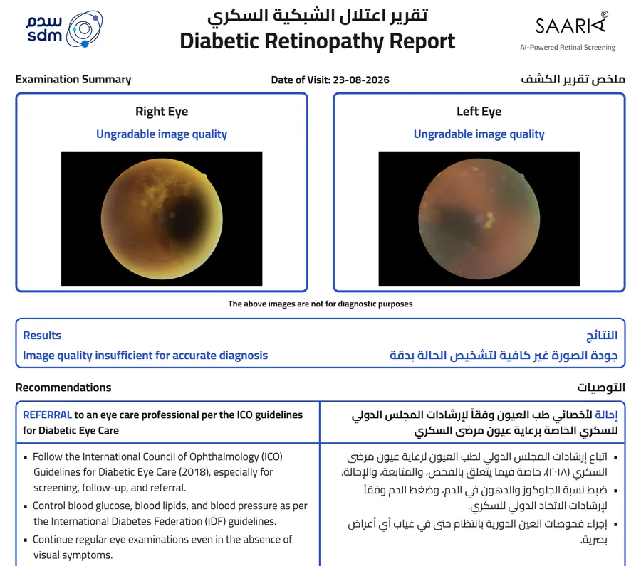 Sample SAARIA report where image quality is insufficient for diagnosis, recommending referral.