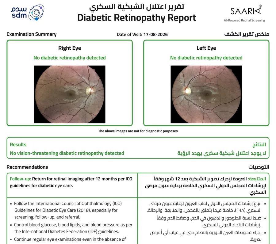 Sample SAARIA report with no signs of diabetic retinopathy, recommending follow-up after 12 months.